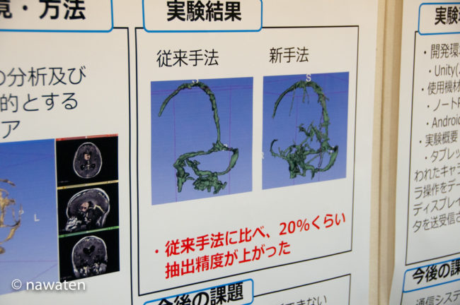 上野貴大さんの「DICOMにおける血管・腫瘍領域分割の精度評価」